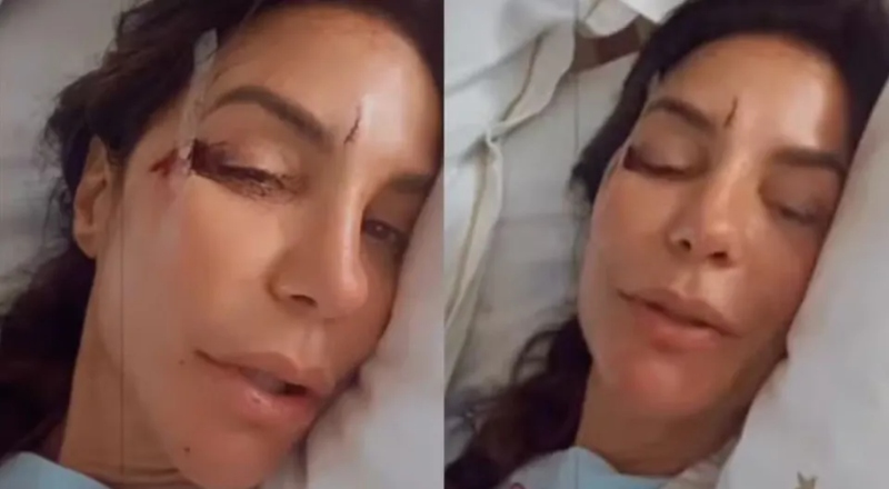 Ivete Sangalo é hospitalizada após passar mal e desmaiar: ‘Caí no chão com tudo’
