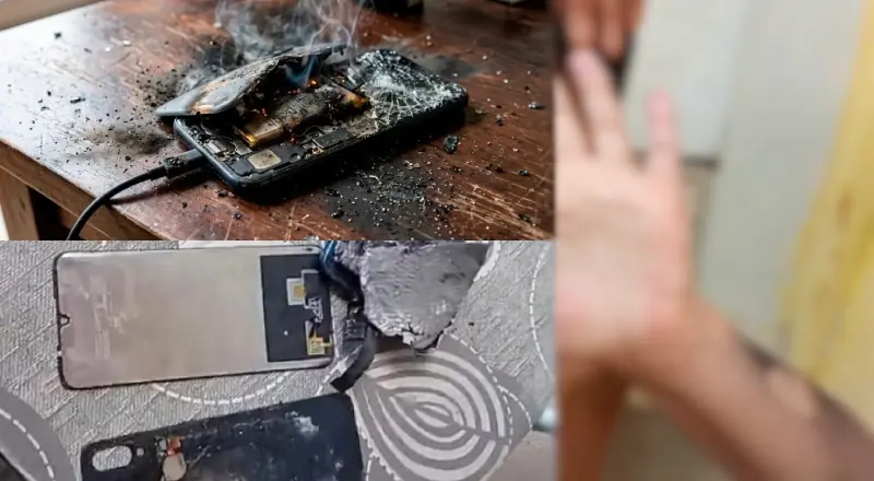 Criança fica com o corpo queimado após celular na tomada explodir enquanto ela jogava Roblox