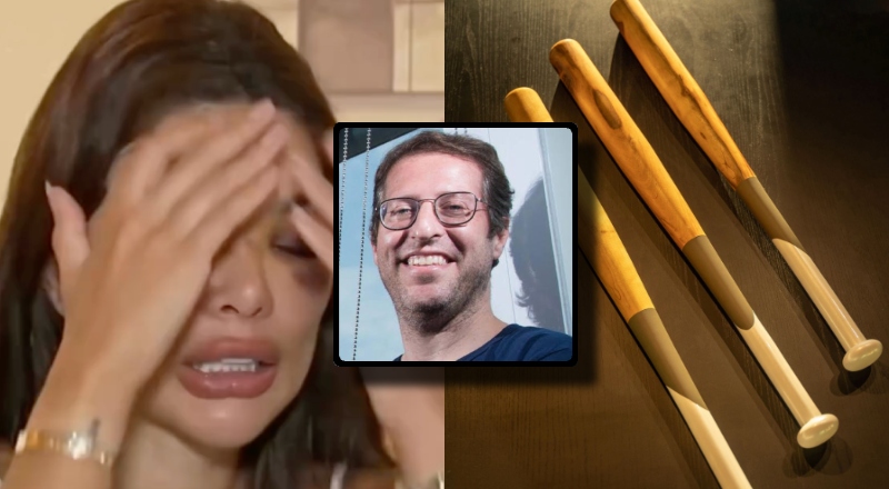 Dentista denuncia maus tratos com taco de beisebol e defesa pede investigação por tentativa de feminicídio; veja vídeo