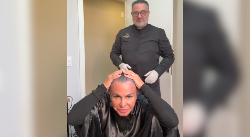 Aos 67 anos, Gretchen raspa a cabeça para transplante capilar e surpreende fãs; veja vídeo